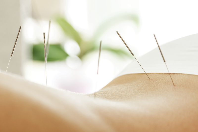 Find Peace With Acupuncture