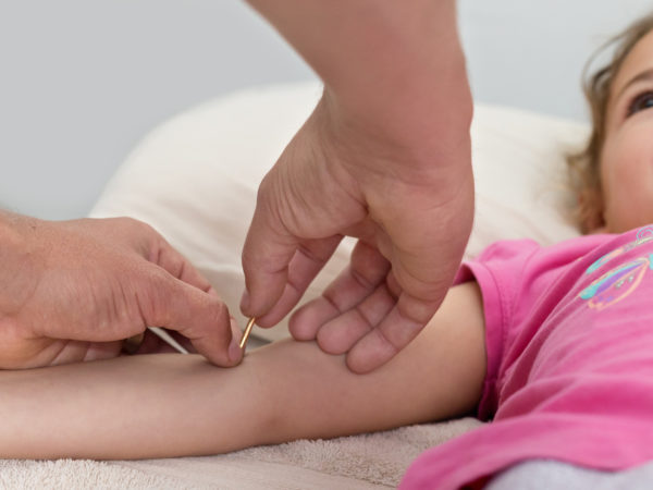 Acupuncture for Anxiety in Children