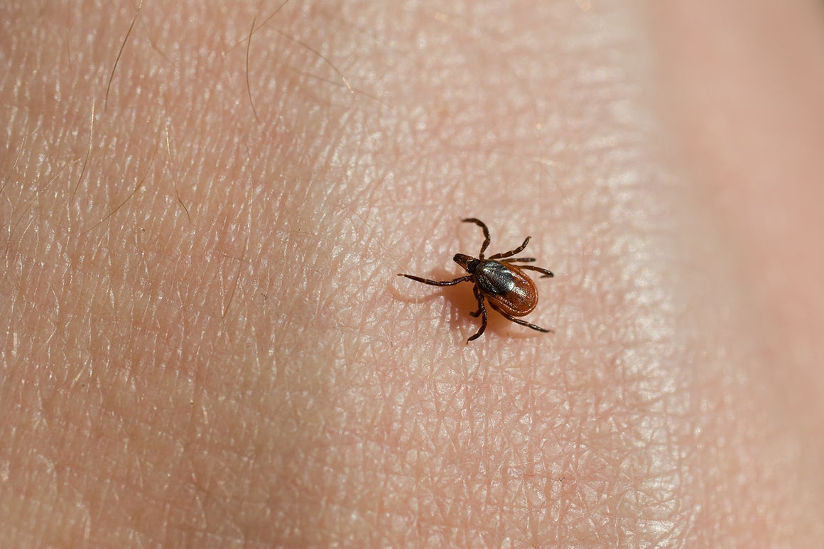 Chronic Lyme Disease: Does It Exist